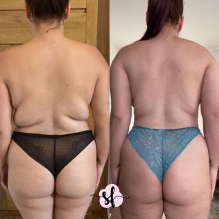 Pokud čekáš dramatickou změnu za pár týdnů, tohle není ten příklad. Pokud ale chceš vidět, jak vypadá reálný posun po dvou...